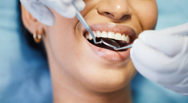 Best Orthodontic Emergency Dentist in Batesburg Leesville, SC